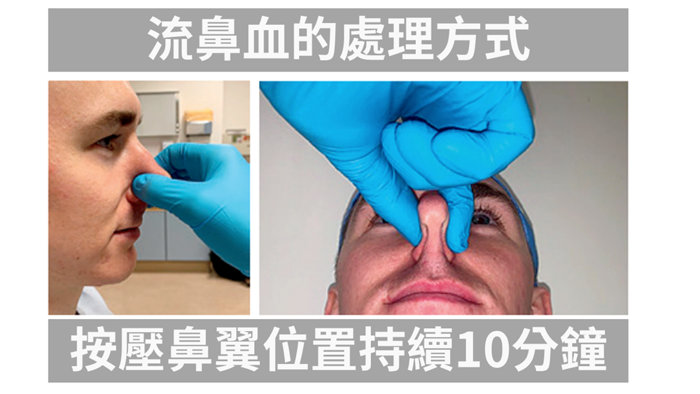 方法