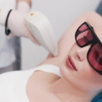 LBEAU BEAUTY冰点除毛护理